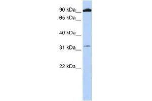 GRM6 antibody used at 0. (Metabotropic Glutamate Receptor 6 抗体  (N-Term))