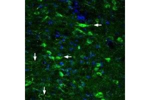 Expression of Glucagon-like peptide 2 receptor in rat hypothalamus - Immunohistochemical staining of rat hypothalamus with Anti-GLP2R (extracellular) Antibody (ABIN7043221, ABIN7044408 and ABIN7044409), (1:200). (GLP2R 抗体  (Extracellular))