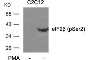 Western blot analysis of extracts from C2C12 cells untreated or treated with PMA using eIF2β (phospho-Ser2). (EIF2S2 抗体  (pSer2))