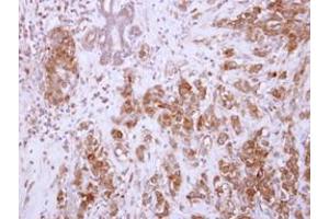 Image no. 1 for anti-Chondroadherin (CHAD) (AA 76-307) antibody (ABIN1497487) (CHAD 抗体  (AA 76-307))