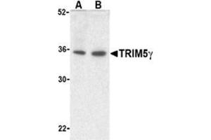 Western blot analysis of TRIM5 gamma expression in human bladder (A) and colon (B) cell lysate with TRIM5 gamma antibody at 2 μg /ml. (TRIM5 抗体  (C-Term, Isoform gamma))