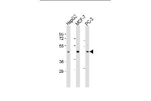 All lanes : Anti-SCD2 Antibody (C-Term) at 1:2000 dilution Lane 1: HepG2 whole cell lysate Lane 2: MCF-7 whole cell lysate Lane 3: PC-3 whole cell lysate Lysates/proteins at 20 μg per lane. (SAPCD2 抗体  (AA 333-367))