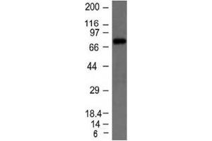 Western blot testing of Raji cell lysate with IgM heavy chain antibody. (小鼠 anti-人 IgM Heavy Chain Antibody)