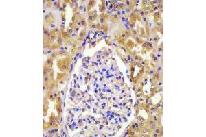 (ABIN390462 and ABIN2840832) staining VHL in human kidney tissue sections by Immunohistochemistry (IHC-P - paraformaldehyde-fixed, paraffin-embedded sections). (VHL 抗体  (N-Term))