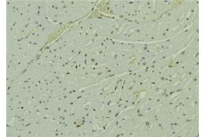 ABIN6273693 at 1/100 staining Mouse muscle tissue by IHC-P. (PAK1IP1 抗体  (C-Term))