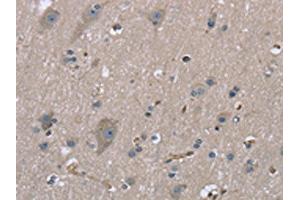 The image on the left is immunohistochemistry of paraffin-embedded Human brain tissue using ABIN7130317(MYL12B Antibody) at dilution 1/20, on the right is treated with fusion protein. (MYL12B 抗体)
