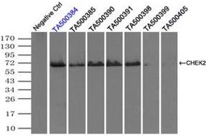 Image no. 3 for anti-Checkpoint Kinase 2 (CHEK2) antibody (ABIN1497497) (CHEK2 抗体)