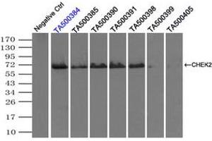 Image no. 3 for anti-Checkpoint Kinase 2 (CHEK2) antibody (ABIN1497497) (CHEK2 抗体)