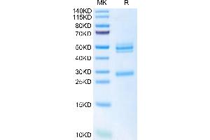 SDS-PAGE (SDS) image for Interleukin 12 (IL12) (AA 23-215) protein (His tag) (ABIN7274908)