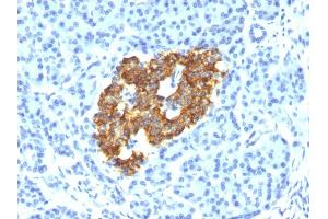 Formalin-fixed, paraffin-embedded human Pancreas stained with Insulin Mouse Monoclonal Antibody (IRDN/794). (Insulin 抗体)