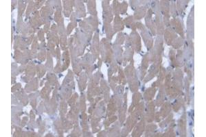 DAB staining on IHC-P; Samples: Rat Cardiac Muscle Tissue (Endothelin 3 抗体  (AA 20-167))