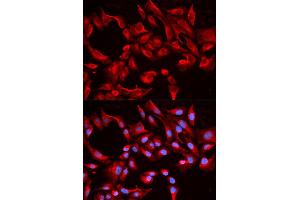 Immunofluorescence analysis of HeLa cell using BCL2L13 antibody. (BCL2L13 抗体)