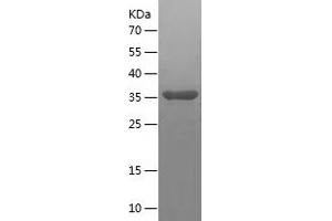 Western Blotting (WB) image for Cyclin-Dependent Kinase 2 Associated Protein 2 (CDK2AP2) (AA 1-126) protein (His-IF2DI Tag) (ABIN7122530) (CDK2AP2 Protein (AA 1-126) (His-IF2DI Tag))