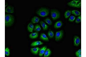 Immunofluorescent analysis of A549 cells using ABIN7171530 at dilution of 1:100 and Alexa Fluor 488-congugated AffiniPure Goat Anti-Rabbit IgG(H+L) (TAS1R2 抗体  (AA 183-362))