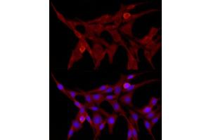 Immunofluorescence analysis of PC-12 cells using TRIM21/SS-A Rabbit pAb (ABIN3015761, ABIN3015762, ABIN3015763 and ABIN6219108) at dilution of 1:50 (40x lens). (TRIM21 抗体  (AA 80-330))