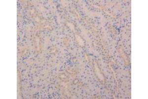 Detection of ANGPT2 in Rat Kidney Tissue using Polyclonal Antibody to Angiopoietin 2 (ANGPT2) (Angiopoietin 2 抗体  (AA 33-243))