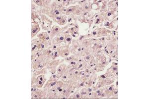 (ABIN6242410 and ABIN6578870) staining IL1R in human liver tissue sections by Immunohistochemistry (IHC-P - paraformaldehyde-fixed, paraffin-embedded sections). (IL1RAP 抗体  (AA 484-518))