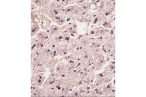 (ABIN6242410 and ABIN6578870) staining IL1R in human liver tissue sections by Immunohistochemistry (IHC-P - paraformaldehyde-fixed, paraffin-embedded sections). (IL1RAP 抗体  (AA 484-518))