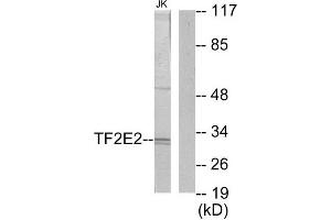 Western Blotting (WB) image for anti-General Transcription Factor IIE, Polypeptide 2 (GTF2E2) (Internal Region) antibody (ABIN1849294) (GTF2E2 抗体  (Internal Region))