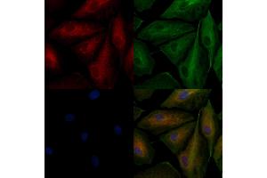 ABIN6257526 and ABIN6276229 staining  cells by IF/ICC.