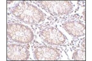Immunohistochemistry of PTK7 in human colon tissue with this product at 5 μg/ml.