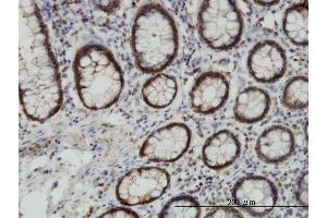 Immunoperoxidase of monoclonal antibody to EPHB3 on formalin-fixed paraffin-embedded human colon. (EPH Receptor B3 抗体  (AA 899-997))