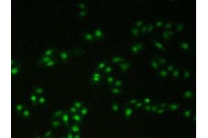 Detection of XRCC5 in Human Hela Cells using Polyclonal Antibody to X-Ray Repair Cross Complementing 5 (XRCC5) (X-Ray Repair Cross Complementing 5 (AA 251-732) 抗体)