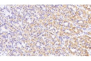 Immunohistochemistry (IHC) image for anti-Keratin 19 (KRT19) (AA 127-322) antibody (ABIN7426235)