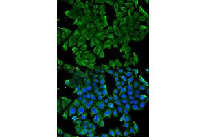 Immunofluorescence analysis of MCF-7 cell using REG3G antibody. (REG3g 抗体)