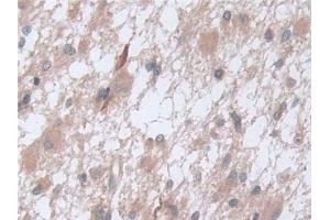 Immunohistochemistry (IHC) image for anti-D-2-Hydroxyglutarate Dehydrogenase (D2HGDH) (AA 56-232) antibody (ABIN7442156)