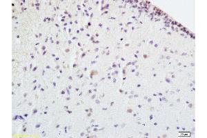 Formalin-fixed and paraffin embedded rat brain tissue labeled withAnti-EPOR Polyclonal Antibody , Unconjugated at 1:100 followed by conjugation to the secondary antibody, (SP-0023), and DAB staining (EPOR 抗体  (AA 301-450))