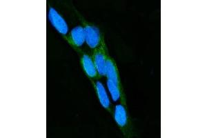 IF analysis of LPO using anti-LPO antibody (ABIN7603067). (LPO (Middle Region) 抗体)