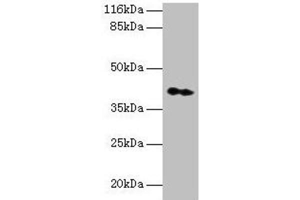 CNTF Receptor alpha antibody  (AA 106-342)