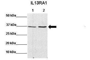 Sample Type: Lane 1:641 µg mouse CT26 lysate Lane 2: 041 µg mouse MC38 lysate Primary Antibody Dilution: 1:0000Secondary Antibody: Anti-rabbit-HRP Secondary Antibody Dilution: 1:0000 Color/Signal Descriptions: IL13RA1  Gene Name: Miranda A. (IL13 Receptor alpha 1 抗体  (N-Term))