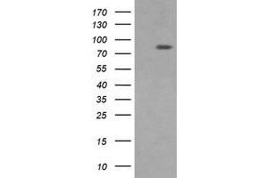 Image no. 5 for anti-Dynamin 1-Like (DNM1L) antibody (ABIN1497872)
