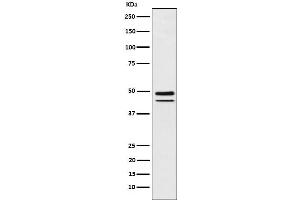 anti-T-Box 19 (TBX19) antibody