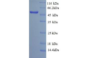 SDS-PAGE (SDS) image for Sialidase 3 (Membrane Sialidase) (Neu3) (AA 2-428) protein (His tag) (ABIN5713078) (Neu3 Protein (AA 2-428) (His tag))