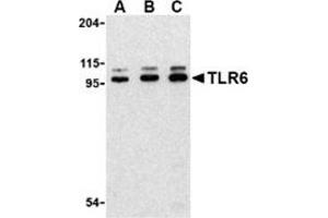 Western blot analysis of TLR6 in Jurkat cell lysate with this product at (A) 0.