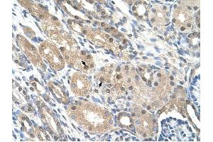 GEM antibody was used for immunohistochemistry at a concentration of 4-8 ug/ml to stain Epithelial cells of renal tubule (arrows) in Human Kidney. (GEM 抗体  (C-Term))