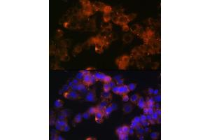 Immunofluorescence analysis of Hep G2 cells using Sonic Hedgehog (Shh) (Shh) Rabbit mAb (ABIN6131215, ABIN6147930, ABIN6147931 and ABIN7101409) at dilution of 1:100 (40x lens). (Sonic Hedgehog 抗体)