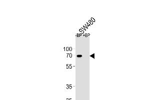 Western blot analysis of ETV5 Antibody (N-term) Pab (ABIN654690 and ABIN2844382) pre-incubated without(lane 1) and with(lane 2) blocking peptide in S cell line lysate. (ETV5 抗体  (N-Term))