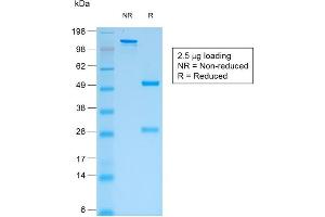 SDS-PAGE Analysis of Purified pan-IgG Mouse Recombinant Monoclonal Antibody ABIN6383781. (Recombinant IGHG 抗体)