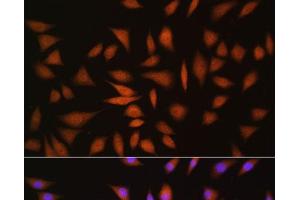 Immunofluorescence analysis of L929 cells using NRBF2 Polyclonal Antibody at dilution of 1:100. (NRBF2 抗体)