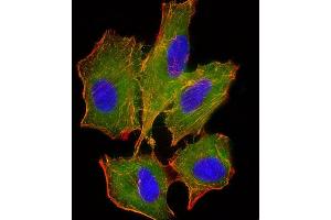 Immunofluorescent analysis of 4% paraformaldehyde-fixed, 0. (BID 抗体)