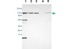 Western blot analysis of Lane 1: RT-4, Lane 2: U-251 MG, Lane 3: A-431, Lane 4: Liver, Lane 5: Tonsil with INTS6 polyclonal antibody at 1:250 - 1:500 dilution. (INTS6 抗体)