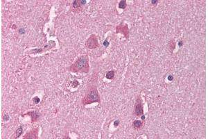 Human Brain, Cortex (formalin-fixed, paraffin-embedded) stained with HSF1 antibody ABIN214116 at 5 ug/ml followed by biotinylated goat anti-rabbit IgG secondary antibody ABIN481713, alkaline phosphatase-streptavidin and chromogen. (HSF1 抗体  (C-Term))