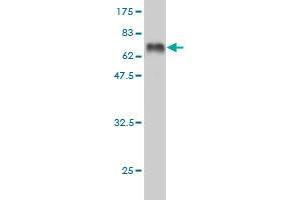 Western Blot detection against Immunogen (65. (Doublecortin 抗体  (AA 1-360))