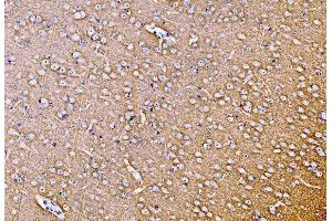 IHC analysis of SYP using anti-SYP antibody (ABIN7603120). (Synaptophysin 抗体  (N-Term))