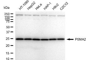 Western blotting analysis using PSMA2 antibody (ABIN7800960). (Recombinant Proteasome 20S Subunit alpha 2 抗体)