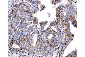IHC analysis of Poliovirus Receptor/PVR using anti-Poliovirus Receptor/PVR antibody (ABIN7601072). (Poliovirus Receptor 抗体  (AA 28-331))